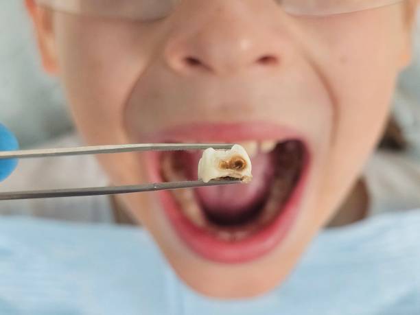 Best Pediatric Emergency Dentist in Westphalia, MD